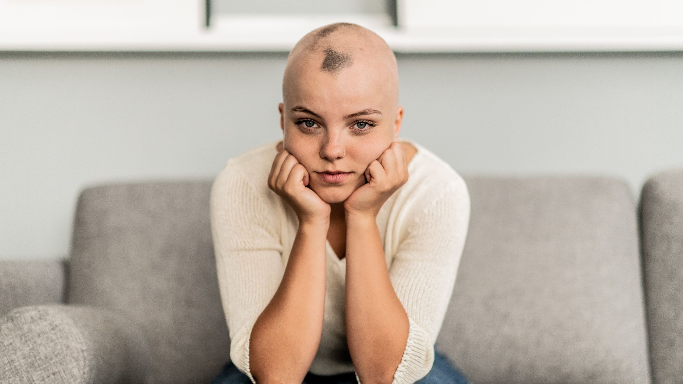 alopecia-hair-loss-treatment (1).jpg
